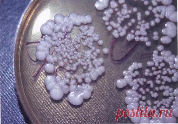 Молочница: факты о заболевании, которые нужно знать - медиаплатформа МирТесен