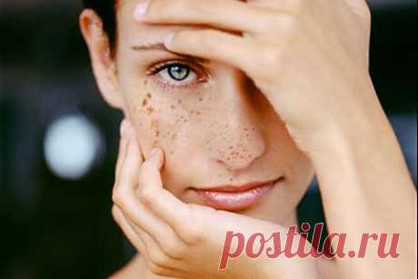 Как избавиться от пигментных пятен | -  zaripowa.aniuta — я.ру