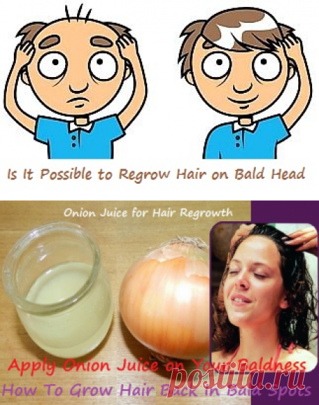 How To Grow Hair Back In Bald Spots | Virtual Clinic