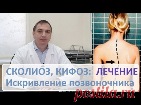 СКОЛИОЗ, кифоз, ЛЕЧЕНИЕ. Искривление позвоночника. Какую гимнастику нужно делать.