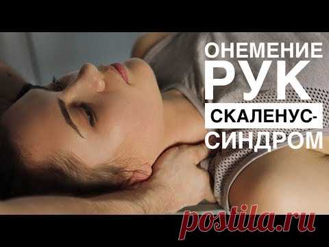 Онемение рук - скаленус синдром