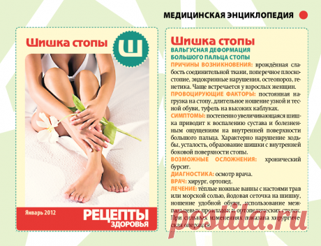 Шишка стопы