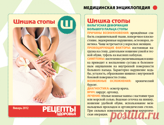 Шишка стопы
