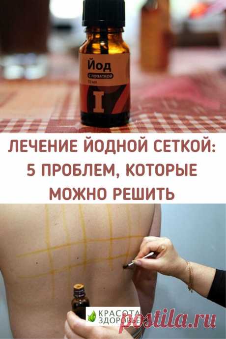 Лечение йодной сеткой: 5 проблем, которые можно решить
Простые линии (так называемая сетка), нарисованные на теле раствором йода, помогают облегчить целый ряд недомоганий за счет двойного действия, которое йод оказывает на организм. ➡️ Читайте подробнее, кликнув на фото