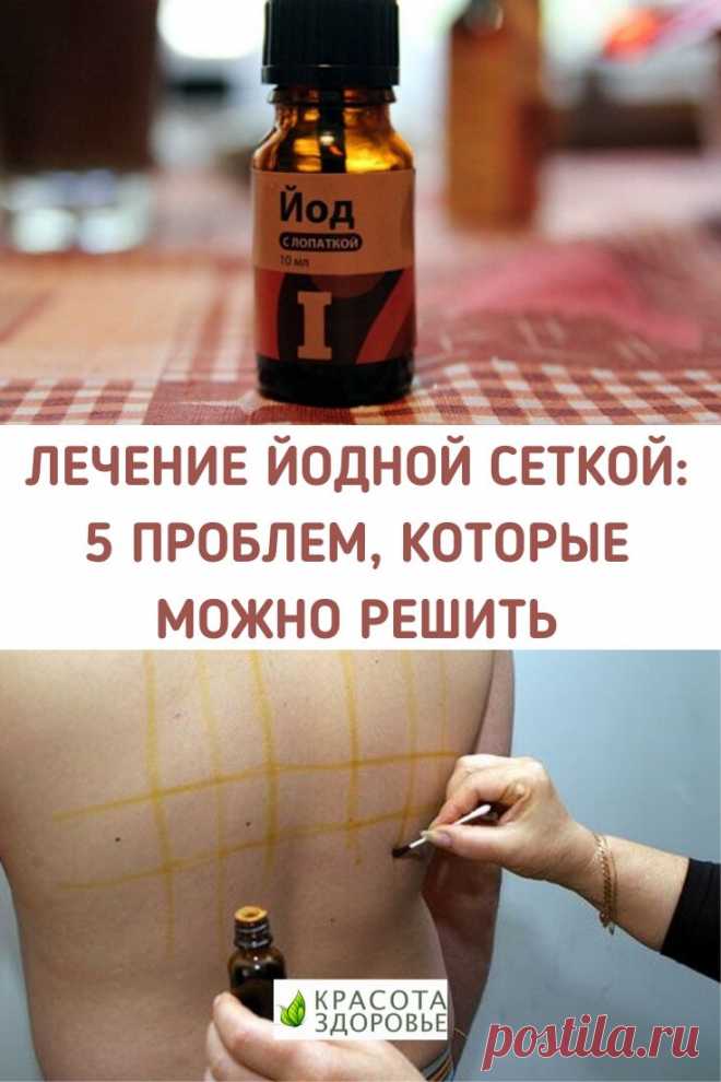 Лечение йодной сеткой: 5 проблем, которые можно решить
Простые линии (так называемая сетка), нарисованные на теле раствором йода, помогают облегчить целый ряд недомоганий за счет двойного действия, которое йод оказывает на организм. ➡️ Читайте подробнее, кликнув на фото