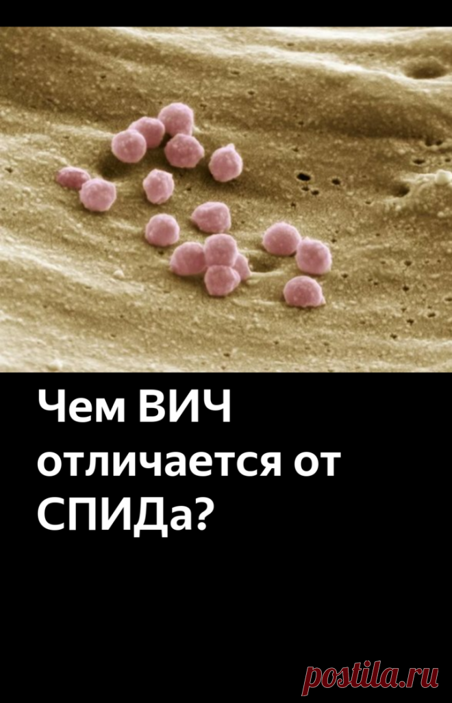 Чем ВИЧ отличается от СПИДа? | Научпоп. Наука для всех | Яндекс Дзен