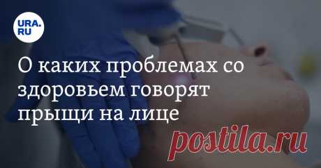 О каких проблемах со здоровьем говорят прыщи на лице Читайте на URA.RU