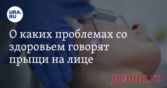 О каких проблемах со здоровьем говорят прыщи на лице Читайте на URA.RU