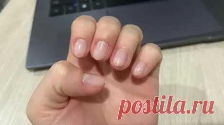 Восстановила ногти на ногах, несмотря на возраст. 3 рабочих способа из личного опыта - ПолонСил.ру - социальная сеть здоровья - Медиаплатформа МирТесен
