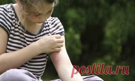 Укусил комар - что делать, чтобы кожа не зудила?