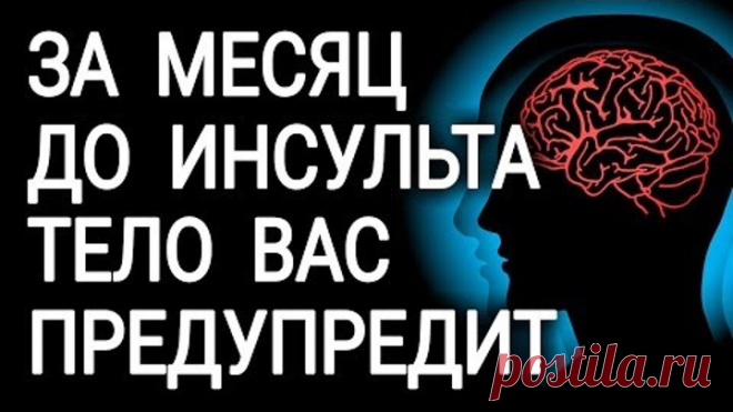 Перед инсультом ваше тело предупредит вас