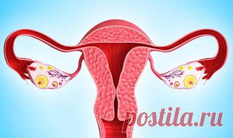 Удаление Полипа Цервикального Канала – Методы Лечения