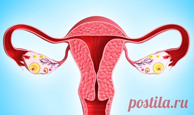 Удаление Полипа Цервикального Канала – Методы Лечения