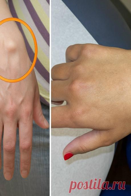 ИЗБАВЛЯЕМСЯ ОТ ЖИРОВИКА