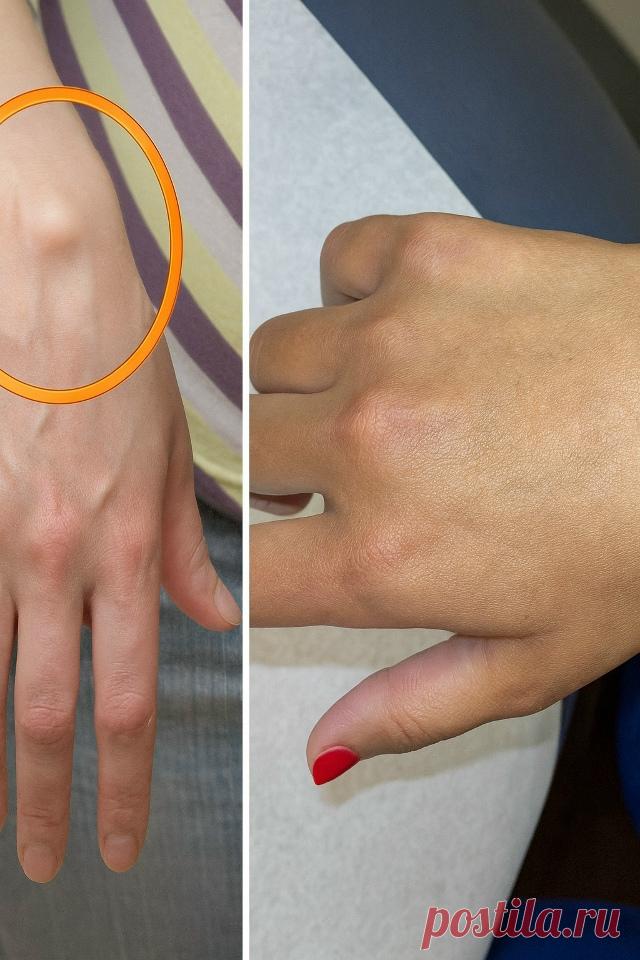 ИЗБАВЛЯЕМСЯ ОТ ЖИРОВИКА