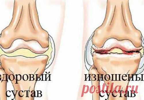 Отличный рецепт от боли в суставах