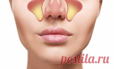 Лечение гайморита народными средствами — Домашние заботы