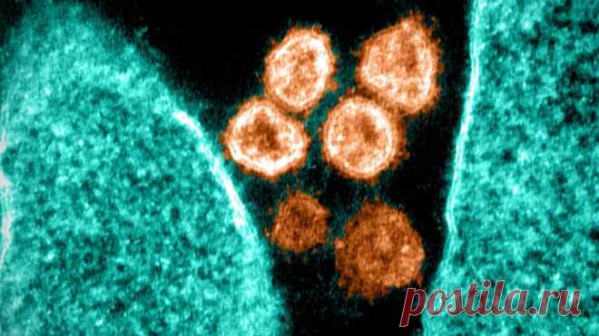 La protéine spike augmente les crises cardiaques et détruit le système immunitaire - Strategika Une nouvelle étude portant sur 566 patients ayant reçu les vaccins Pfizer ou Moderna montre que les signes de dommages cardiovasculaires ont augmenté après les injections. Le risque de crise cardiaque ou d’autres problèmes coronariens graves a plus que doublé plusieurs mois après l’administration des vaccins, d’après les modifications des marqueurs d’inflammation et d’autres dom...