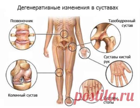 Как принимать желатин для суставов?