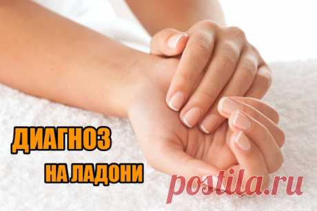 ПРИЗНАКИ БОЛЕЗНЕЙ ЧЕЛОВЕКА ПО ЛАДОНЯМ 

 
* Красные ладони говорят о поражении печени. Также стоит проверить печень, если ладони приобретают желтоватый оттенок.
 
* Если краснеют только кончики пальцев, то стоит задуматься о своем пищевар…