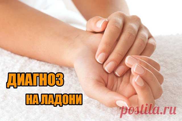 ПРИЗНАКИ БОЛЕЗНЕЙ ЧЕЛОВЕКА ПО ЛАДОНЯМ 

 
* Красные ладони говорят о поражении печени. Также стоит проверить печень, если ладони приобретают желтоватый оттенок.
 
* Если краснеют только кончики пальцев, то стоит задуматься о своем пищевар…