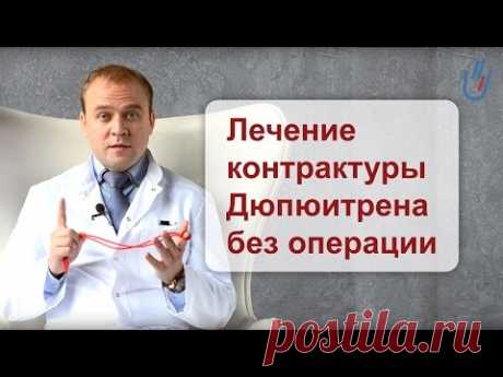 Лечение контрактуры Дюпюитрена без операции