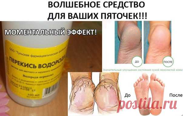 КОПЕЕЧНОЕ СРЕДСТВО ДЛЯ УХОДА ЗА ПЯТКАМИ 
Эффект потрясающий!!! Попробуйте и убедитесь сами!

Уже через несколько минут создаётся такое впечатление, что вы парили ноги по крайней мере полчаса. Вы сами почувствуете эффект, когда потрёте нога об ногу, как они 