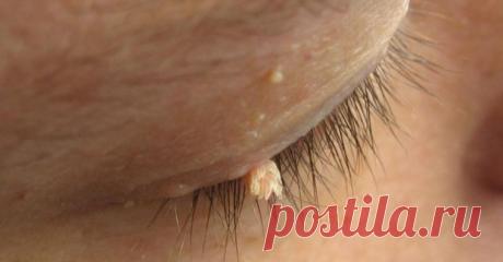 Народные рецепты от дефектов кожи - Полезные Советы