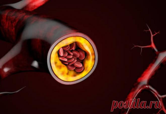 Высокий холестерин. Три простых пищевых правила для его снижения Медики советуют придерживаться нескольких простых правил в повседневном питании, помогающих добиться снижения повышенного уровня холестерина. В частности, они считают важным употреблять в пищу определенные продукты.