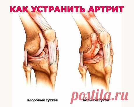 (62) Одноклассники