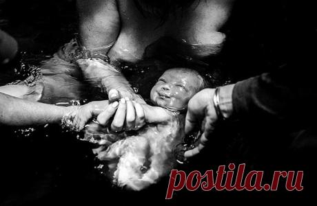 Фотографии (из которых некоторые вообще не для слабонервных) показывают чудо человеческого рождения в деталях (слишком подробных)
