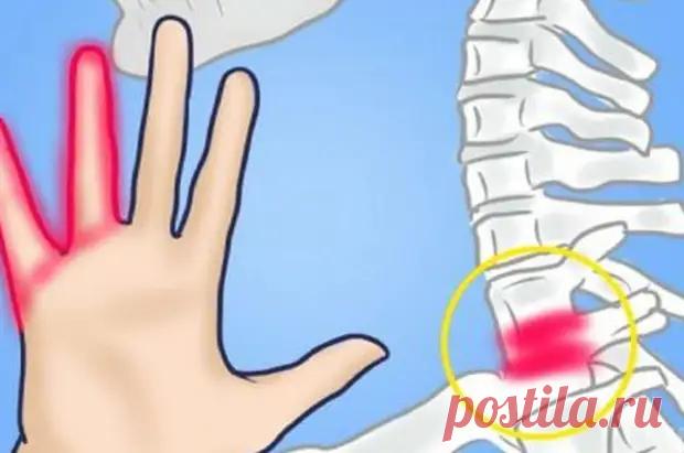 Кисти теряют силы – слабость в руках - МедРу - 7 января - 43779769940 - Медиаплатформа МирТесен