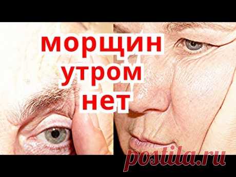 Морщин Утром Нет! Лёгкий Способ От Сонных Морщин На Лице! Омоложение