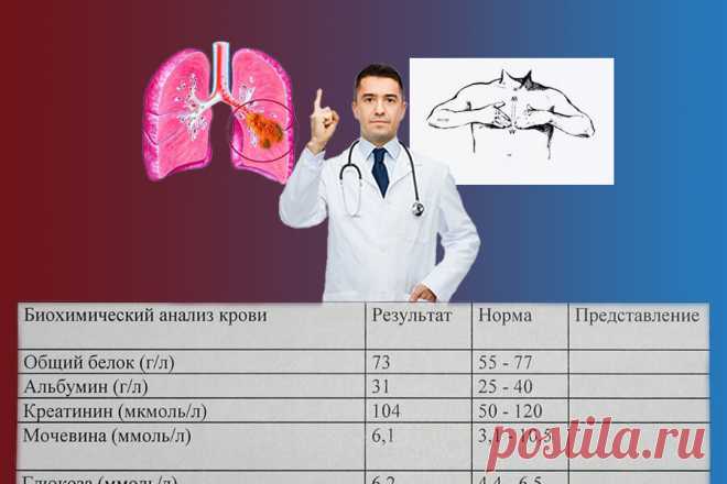 Как быстро улучшить работу легких. Простые упражнения для профилактики пневмонии | Секреты здоровья | Яндекс Дзен