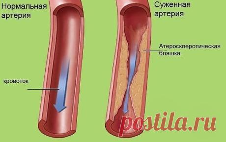 чистка ОРГАНИЗМА | Записи в рубрике чистка ОРГАНИЗМА | Дневник сини4ка