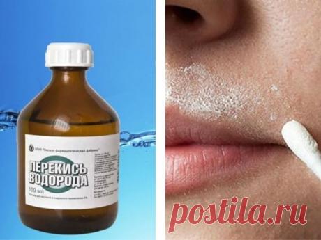 Обесцвечивание и удаление нежелательных волос на теле

Смесь 1 ч. л. 6% перекиси водорода с 1 ч. л. жидкого мыла и 5 каплями нашатырного спирта.
Эмульсию нанести на волосистую часть кожи на 10-15 минут.

Смыть настойкой ромашки.

Процедуру делать 1 раз в неделю вечером.
Волосы посветлеют, истончатся и практически перестанут расти.

А вы знаете об этом рецепте? 
Сохраняйте себе и будьте неотразимы.
