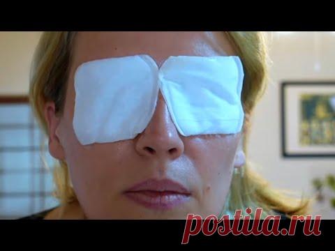 Веки подтянулись Морщины вокруг глаз разгладились.Подтяжка лица.Домашнее средство