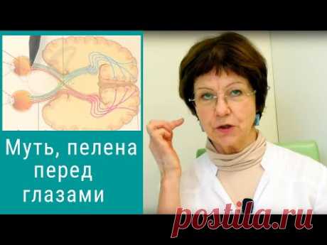 Муть в глазах, пелена перед глазами - что это значит и что делать? - YouTube