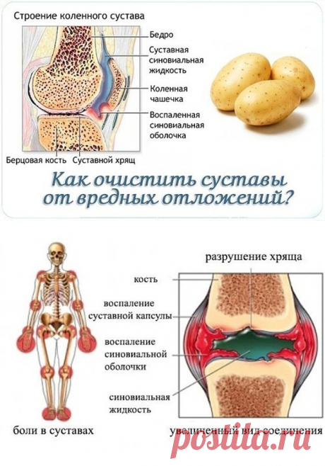 КОЛЕНО