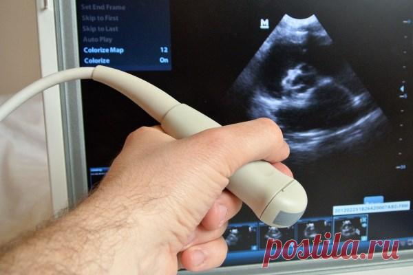 УЗИ половых органов (гениталий) у женщин и мужчин: показания, подготовка, виды исследований, расшифровка результатов, цены