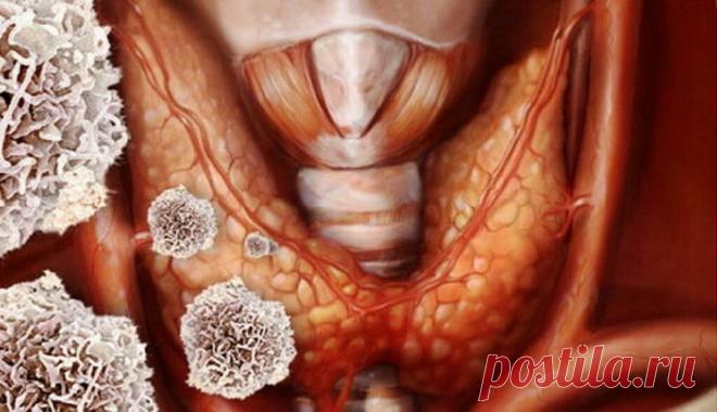 Аутоиммунный тиреоидит и дисбактериоз кишечника | ОкейДок | Яндекс Дзен