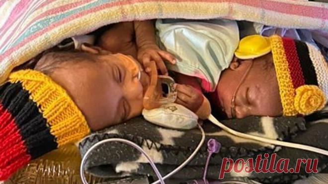 В Австралии врачи разделили сиамских близнецов, но одного из них не спасли. Сиамские близнецы из Папуа — Новой Гвинеи были экстренно доставлены в Австралию для проведения сложной операции по разделению. Однако выжить удалось лишь одному из мальчиков, пишет ABC News. Сиамских близнецов Тома и Савонга ...