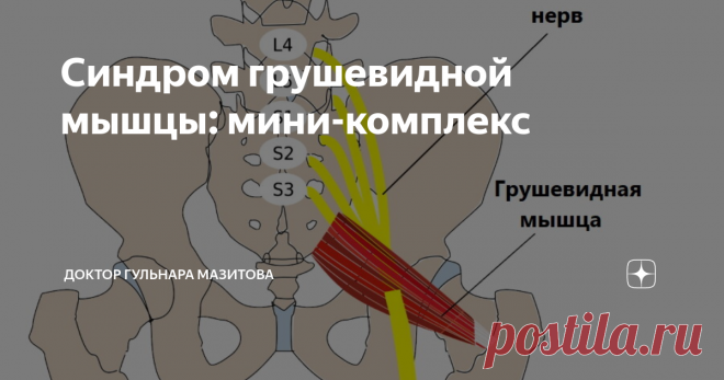 Синдром грушевидной мышцы: мини-комплекс О грушевидной мышце вряд ли знает обычный человек.
Пока не возникнет её спазм. Пропустить такое не получится 👉 боль словно электрический ток пронзает ногу. Мышца защемляет седалищный нерв - самый толстый в организме. Этот нерв проходит от крестца до стоп.