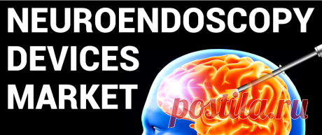 Neuroendoscopy Devices Market Size, 2026 | Industry Report