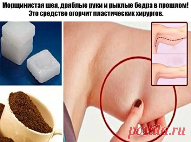 Морщинистая шея, дряблые руки и рыхлые бедра в прошлом! Это средство огорчит пластических хирургов Потерявшая упругость, обвисшая кожа на руках, шее, животе и бедрах — нередкое явление у женщин после 45 лет. Увлечение диетами, резкое похудение, гормональные сбои — всё это сказывается на состоянии к