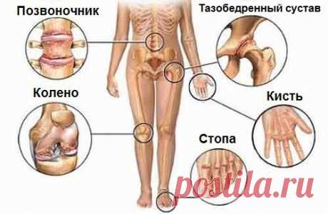 Попрощайся с болью в суставах!
