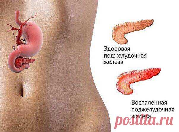 Поджелудочную железу исцеляет семя льна. Очень простой рецепт.
ЕСЛИ БЕСПОКОИТ ПОДЖЕЛУДОЧНАЯ ЖЕЛЕЗА

Есть способ не только облегчить страдания, но и навсегда забыть о этой напасти..... Это семя льна..., оно единственное! способно вылечить вашу поджелудочную железу.

Нужно:

Свежемолотую столовую ложку семян льна заварить 0,5 стакана кипятка.... Дать потомиться на слабом огне 5 минут при закрытой крышке и оставить остывать в таком состоянии..... а тёпленьким, как остынет - в...