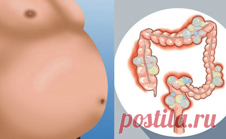 Вздутие живота. Упражнения, которые помогут избавиться от газа внутри кишечника | Фитнес - стиль жизни | Яндекс Дзен