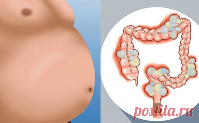 Вздутие живота. Упражнения, которые помогут избавиться от газа внутри кишечника | Фитнес - стиль жизни | Яндекс Дзен