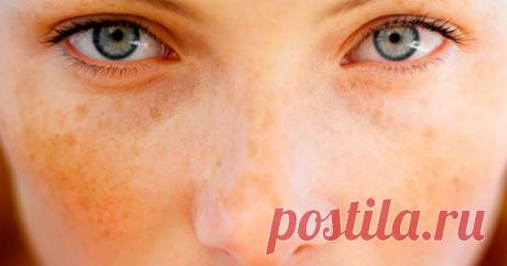 Домашний лосьон, отбеливающий веснушки и темные пятна - Образованная Сова Этот домашний лосьон сделан из лимона (или натурального яблочного уксуса) и листьев петрушки. Он поможет Вам отбелить кожу, убрать веснушки и темные пятна на лице. После его использования ваша кожа будет иметь ровный цвет и ухоженный вид. Петрушка богата минералами и витаминами. Сок этого растения содержит эфирные масла, богатые содержанием марганца и калия. Она может быть использован в качестве лека...